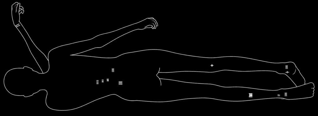 otzi