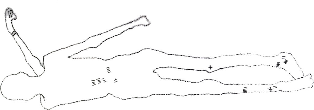 tatuajes de Ötzi, mapa de ubicaciones en el cuerpo